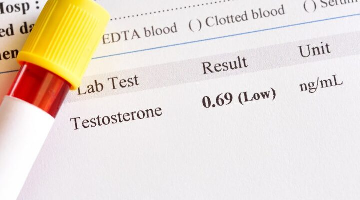 inForm-Is-City-Living-Really-Affecting-Your-Testosterone--header