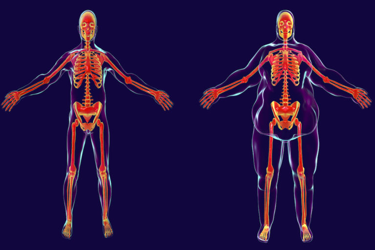 are-you-lean-but-metabolically-obese-form